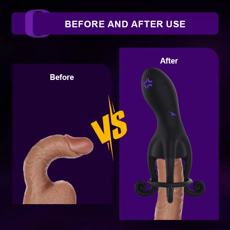 XG11: Octopus Male Glans Trainer with 10 Vibration Modes